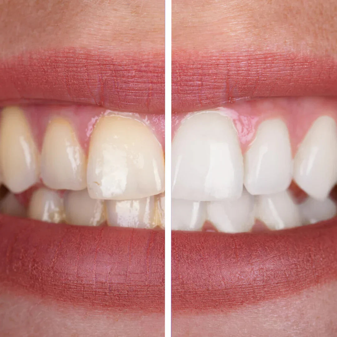 ScandinavianSmiles – Dentifrice violet blanchissant