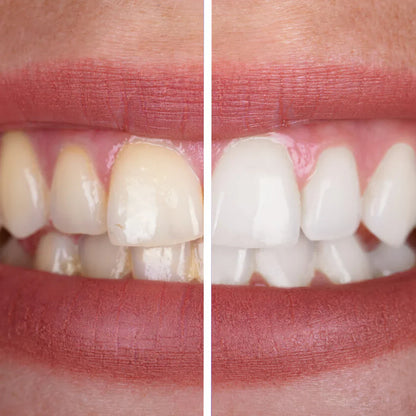 ScandinavianSmiles – Dentifrice violet blanchissant